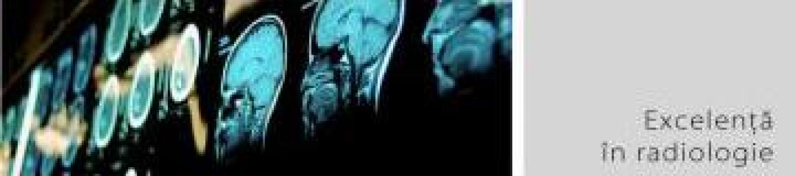 Investigatii IRM - abdomen de la Explora Rx Srl
