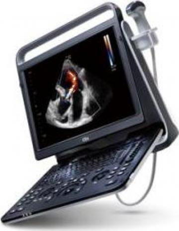 Ecocardiograf Doppler portabil Chison Ebit 60 de la Soniworld Aparatura Medicala Srl