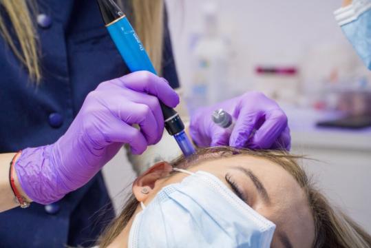 Curs Masterclass Mezoterapie scalp